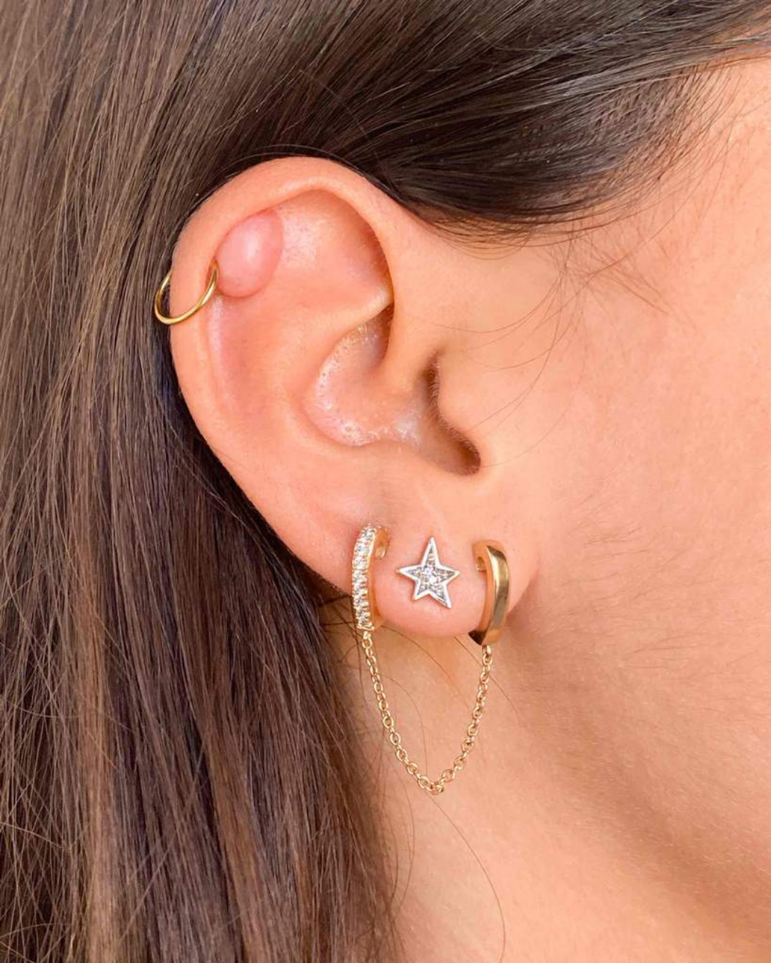cheloide piercing